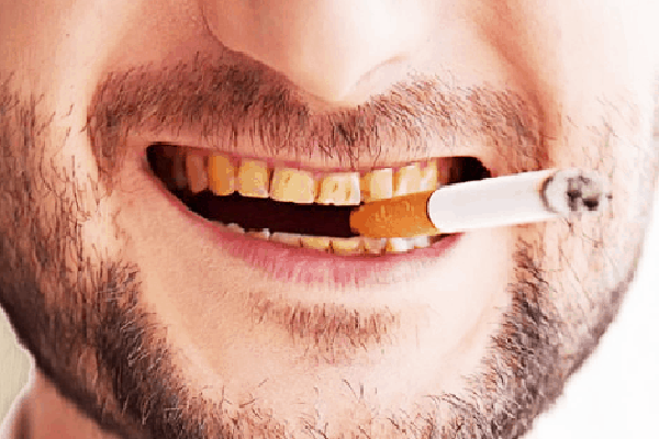 سیگار سلامت دندان‌هایتان را هم دود می‌کند!